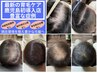 【特典付】毛髪悩みのお試しに◎【プロセルセラピーズorミラクルショット】