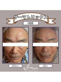 ビーマジック(美magic)/#サーマトリックス 