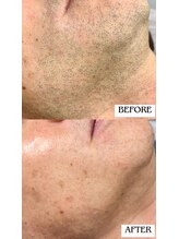 バディーズ(BUDDieS)/50代