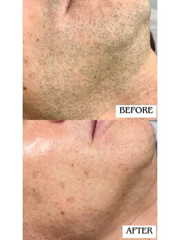 バディーズ(BUDDieS)/50代