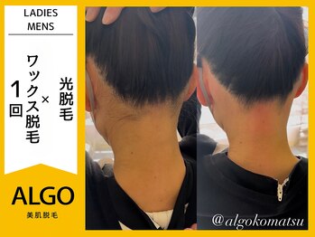アルゴ 小松店(ALGO)/うなじはワックス脱毛一択！！！