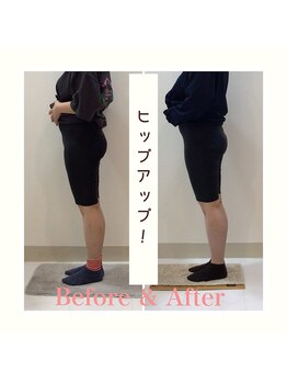 スタイルラボ高松/産後の骨盤矯正の効果♪