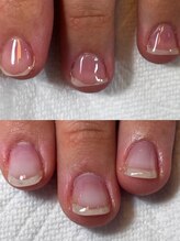 ハンド ケイ(Hand K)/自爪育成