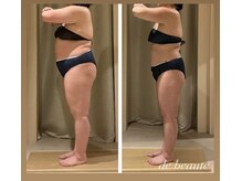 ドゥ ボーテ(de beaute)