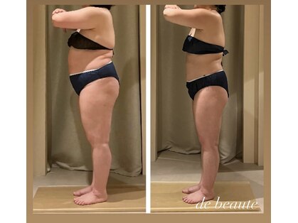 ドゥ ボーテ(de beaute)の写真