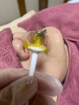 サロンアンドスクール ローズマリー (Salon&School Rosemary)/ノーズワックス(鼻毛脱毛)¥3300