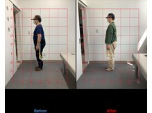 リード整骨院(LEAD整骨院)/反り腰お悩みに方お任せください