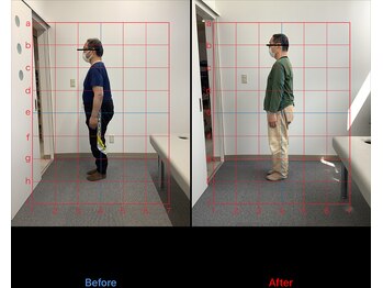 リード整骨院(LEAD整骨院)/反り腰お悩みに方お任せください