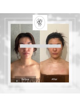 メグルサロン 自由が丘(MeguruSalon)/小顔矯正