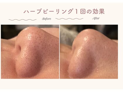 オートクチュール エステティックサロン シーズの写真