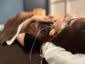 シエル(SieL)の写真/国家資格保有・経験豊富なプロ在籍。全ての美容鍼メニューが「頭皮ケア」付き。ヘッドスパや眼精疲労ケアも