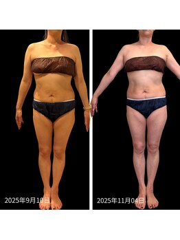 クールヴィラ(Cool Villa)/