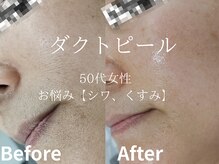 メイプル(Maple)/50代女性/お悩み→シワ、くすみ