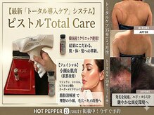 ルアナ(Luana)の雰囲気（脂肪を撃退！小顔♪二の腕にも♪ダウンタイムなし！）