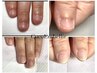 ［hand］深爪改善　クリアジェル仕上げ　