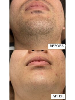 バディーズ(BUDDieS)/20代