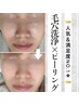 <人気No1◎>毛穴洗浄+お好きなピーリング+ヘッド5分 80分15,000→10,000円