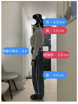ナオル整体 渋谷院(NAORU整体)/最新AIであなたの歪みを数値化