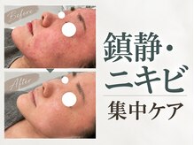 サンラックスサロン 岐阜(SANlux Salon)