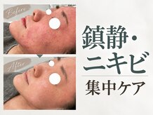 サンラックスサロン 岐阜(SANlux Salon)