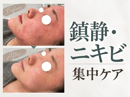 サンラックスサロン 岐阜(SANlux Salon)の写真