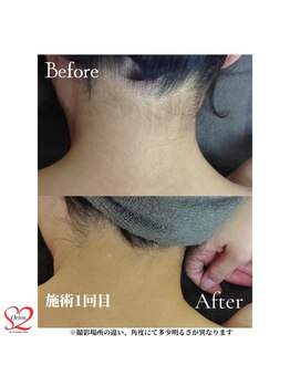 オリオンドットエスツー(Orion.S2)/【Before→After】