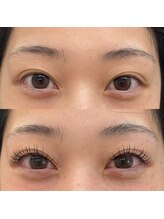 スリール(sourire)/＆Healthy×フラット１0０本