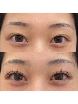 スリール(sourire)/＆Healthy×フラット１0０本