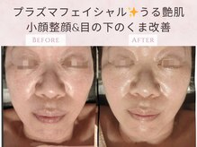 藍/小顔造顔の効果★