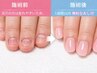 深爪改善コース(チップ長さだし10本)