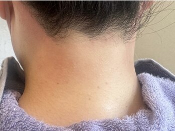 ミラ 本厚木(Mira.)/うなじワックス　after