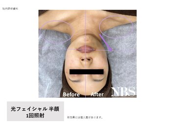 アモ(AMO)の写真/年齢によるたるみケアを追求。シミケアやシワ改善へ導く贅沢なエステで笑顔に◎