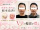 マルウル(maluulu)の写真