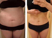 ヨサパーク ナナラーレア 福島店(YOSA PARK nanala lea)/痩身/ダイエット/リンパ/水素