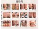 フットメンテ 巻き爪矯正センター 南浦和の写真