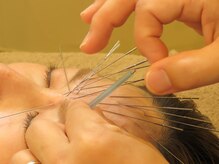 ぶあ鍼灸室の雰囲気（ルート鍼灸で根本的に症状を改善。人生が変わります）