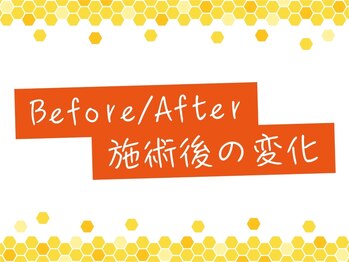 エゾマル(Ezo-maru)/【施術例】ビフォーアフター