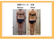 リヴェーヌ 富山店/全身　筋膜リリース