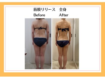 リヴェーヌ 富山店/全身　筋膜リリース