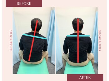 浦安駅前鍼灸整体院/before&after