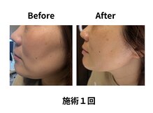 ティアレソワン(tiare soin)