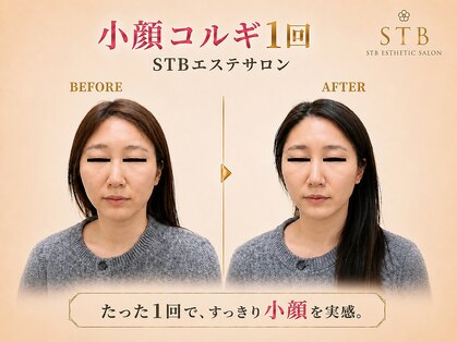 STBエステサロンの写真