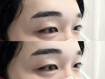 アマンズアイ(amans eye)/