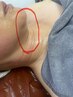韓国最新美容機器オンダリフト+韓国パック+背中コルギ