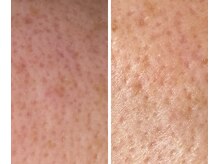 サイ(Sai)/before⇒after