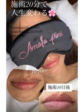 フジモトサロン 那覇おもろまち店(fujimotoサロン)/アマラピンク施術10日後