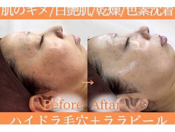 シルキーエービューティー(Silky A Beauty)/水光肌になりたい方に