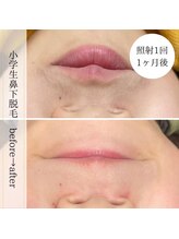 ココスターリー 大橋店(Coco starry)/