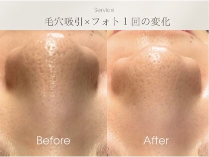 ベルダ(BELDAD)の写真