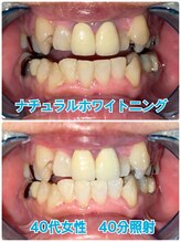 プラチナムビューティー 川口駅前店(PLATINUM BEAUTY)/コーティング機能によりツヤも